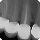 imagen menu endodoncia