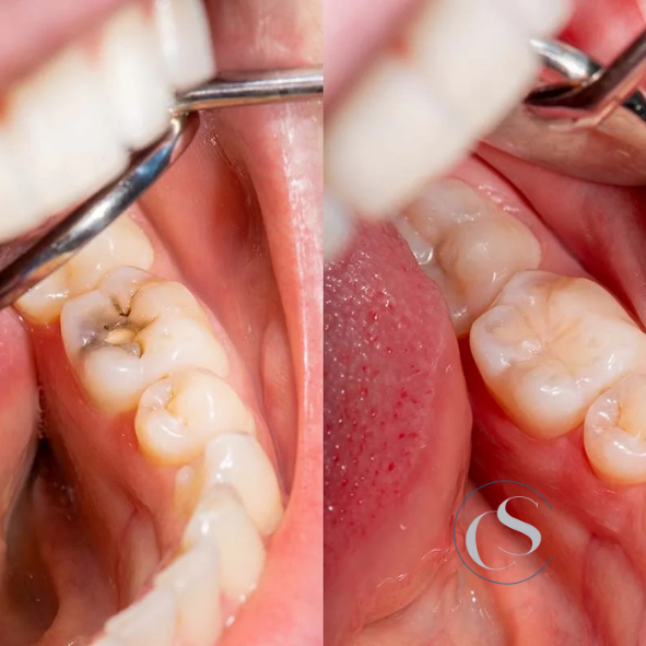 empaste dental