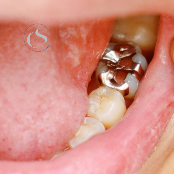 empaste dental