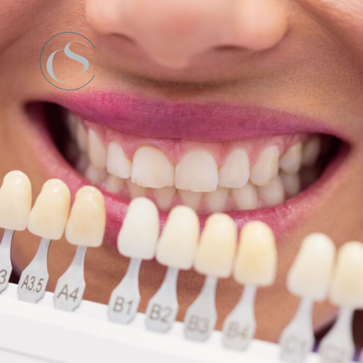 estética dental en verano