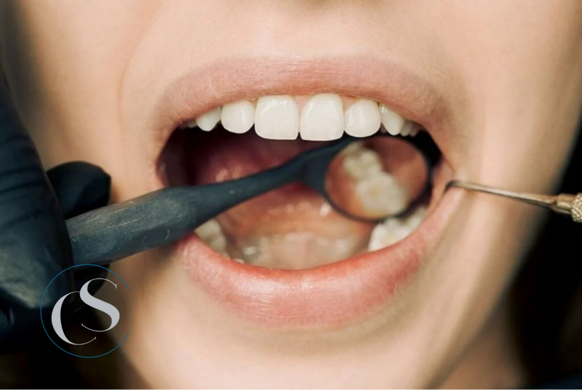 flemón dental