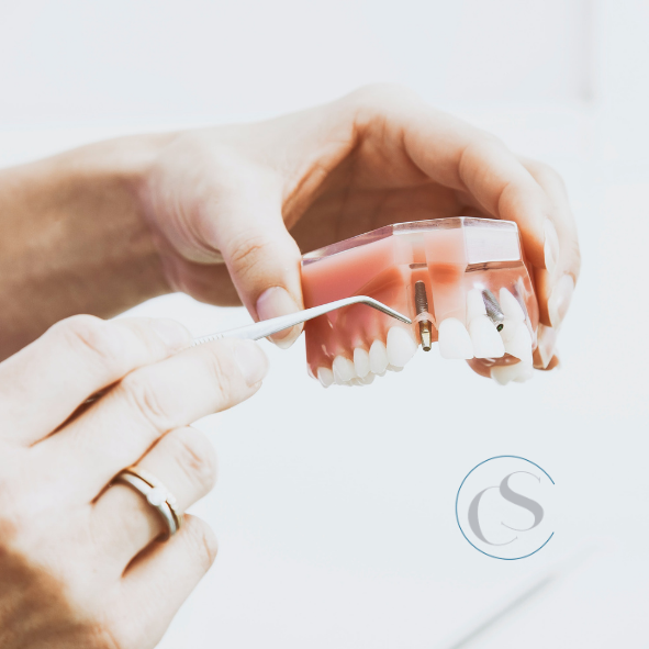 implantes dentales en carabanchel