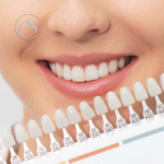 Blanquea tus dientes en Carabanchel