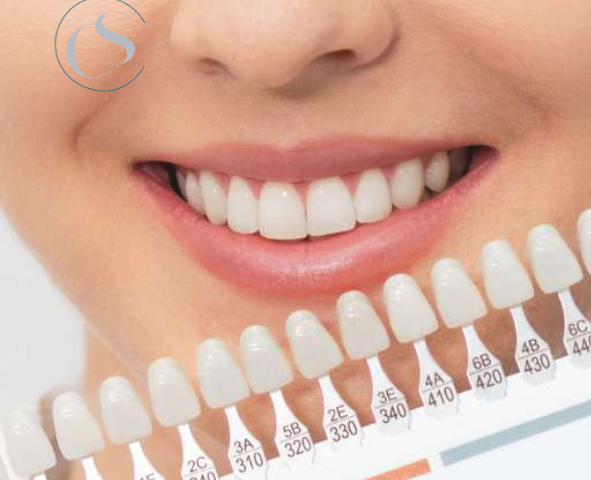 Blanquea tus dientes en Carabanchel