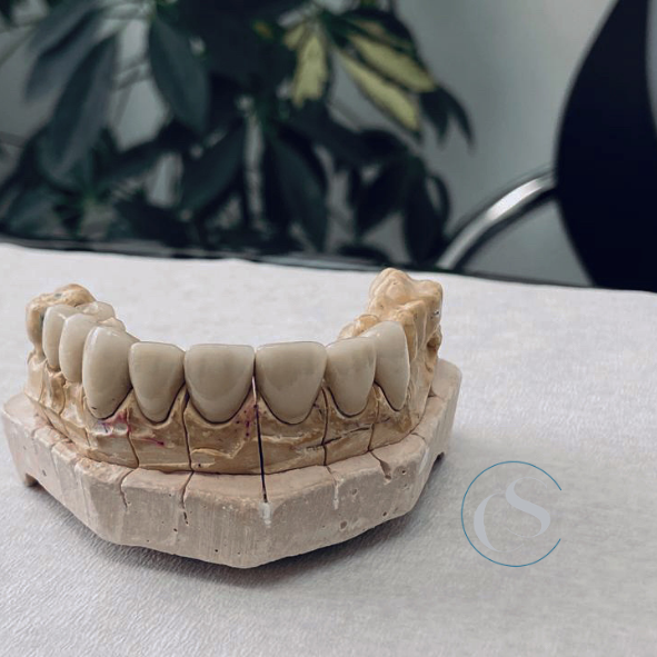 clínica dental en Carabanchel