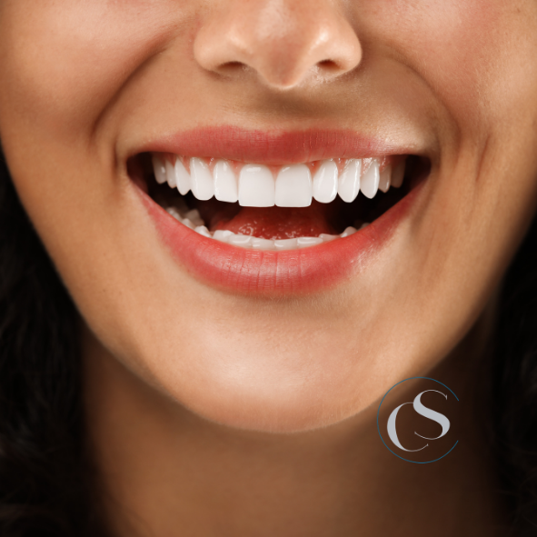 Estética dental en Madrid Río