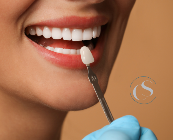 Estética dental en Madrid Río