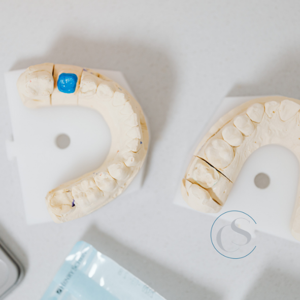 Estética dental en Madrid Río