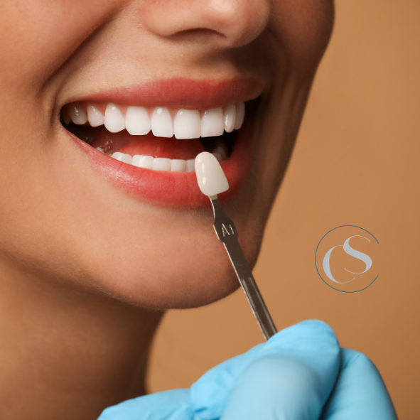 Estética dental en Madrid Río