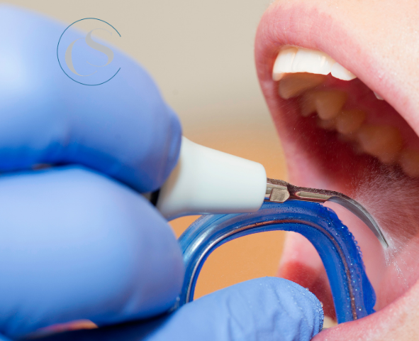 limpieza dental profesional
