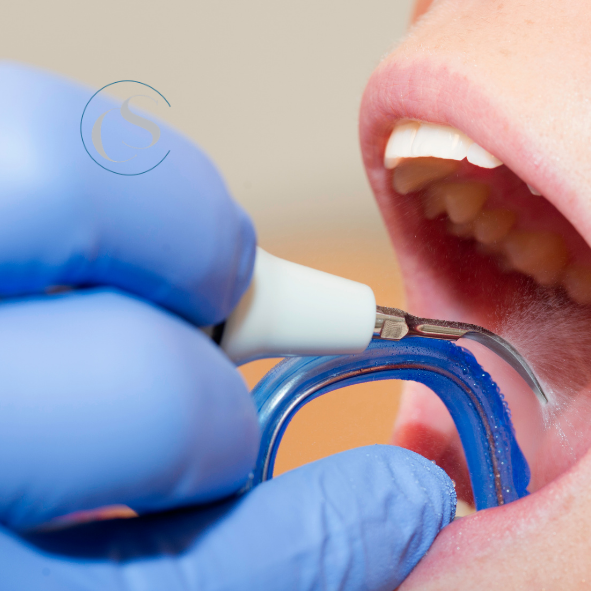 limpieza dental profesional