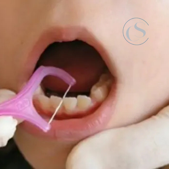 uso del cepillo interdental