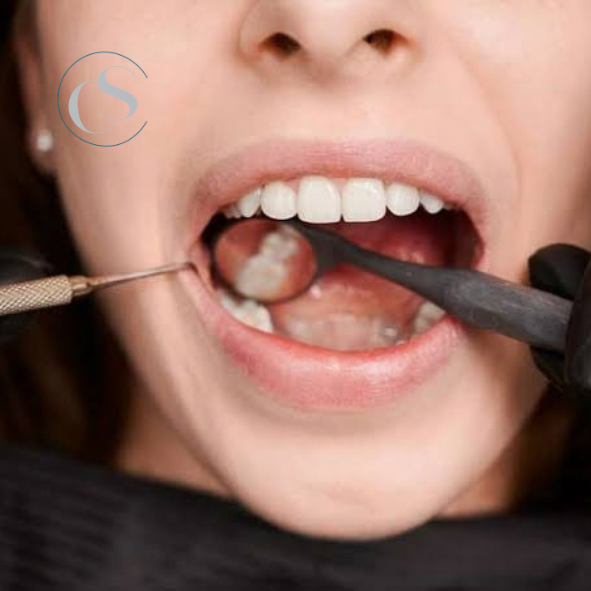cómo se trata un flemón dental carabanchel
