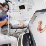 impresión digital dental