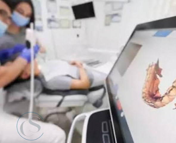 impresión digital dental