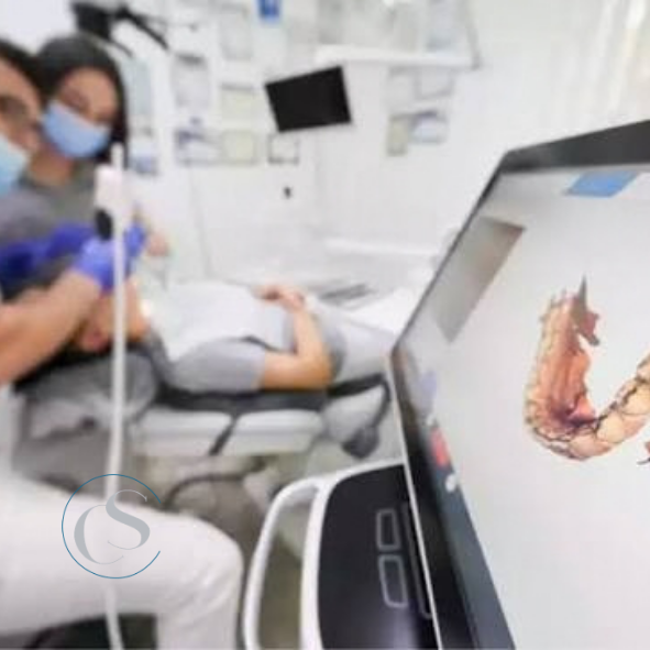 impresión digital dental