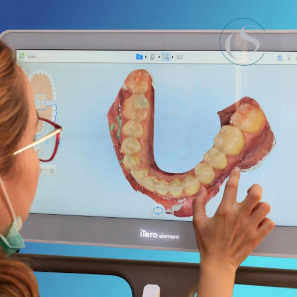 clínica dental con escáner intraoral en Madrid Río